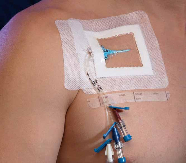 sorbaview central line dressing Sorbaview Shield Catheter Positioning Dressing, Contour, 3.75" x 4.25